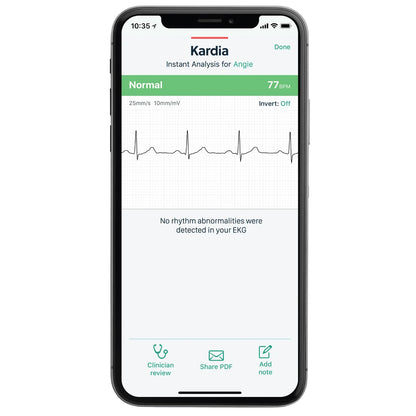 ECG personnel KardiaMobile avec boîtier de transport